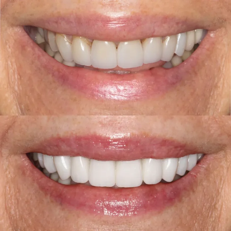 66f5a297aa200bfc1fedf608_2-768x768