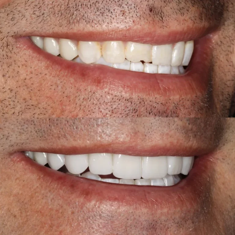 66f5a297aa200bfc1fedf609_3-768x768