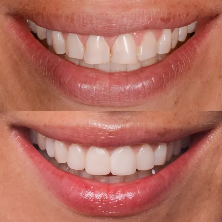 66f5a297aa200bfc1fedf60e_2-768x768