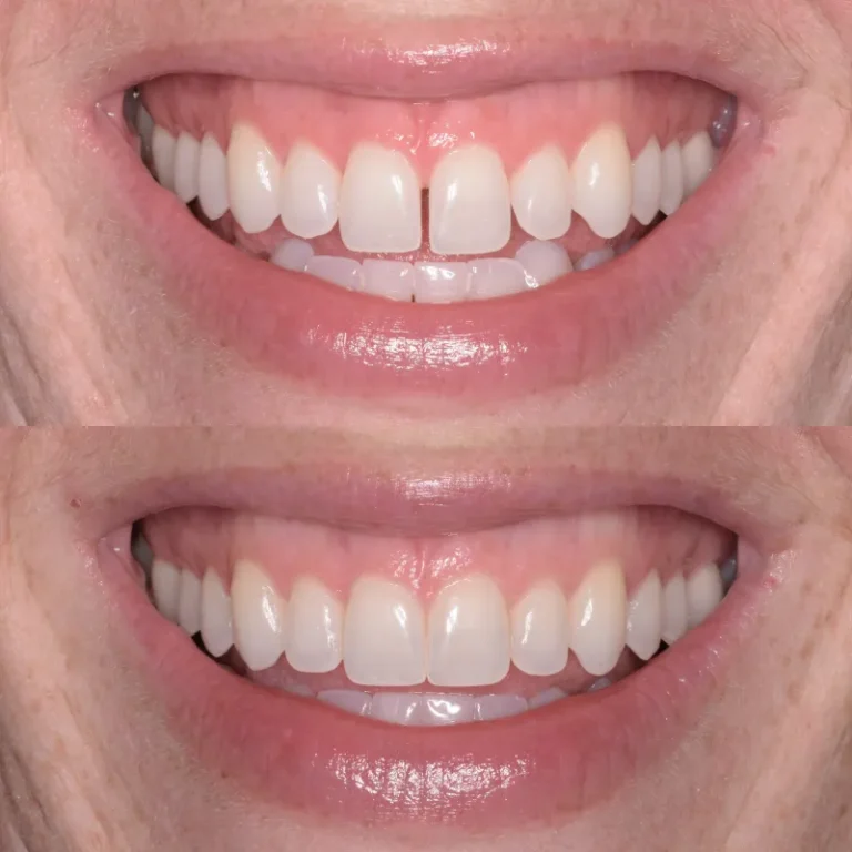 66f5a297aa200bfc1fedf60f_4-1-768x768