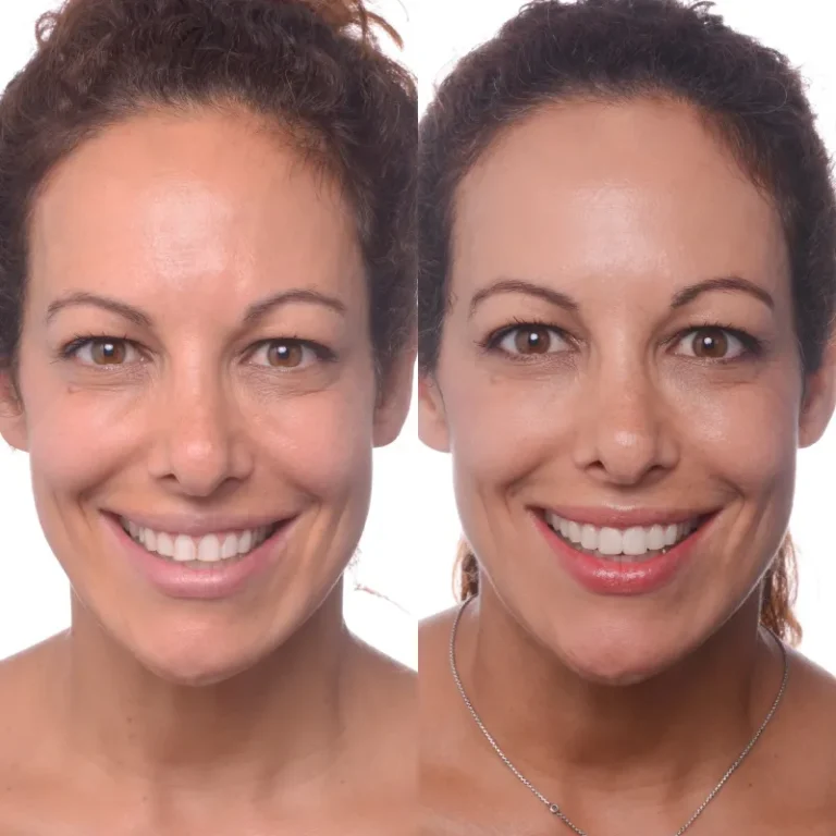 66f5a297aa200bfc1fedf610_1-768x768