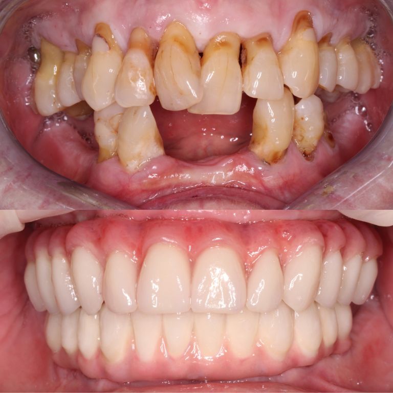 Untitled design (99)